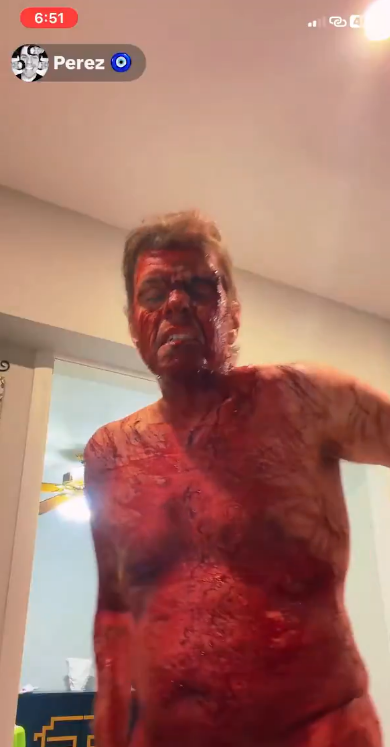 Perez Hilton Cutting Himself